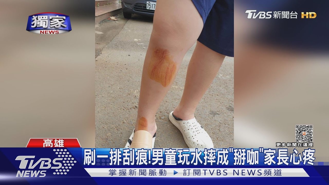刷一排刮痕!親水公園開幕首日 逾10名孩童掛彩