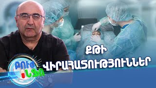 Բուժ ինֆո/Buj Info/Խորհուրդ մասնագետից/Երբ է ցուցված քթի վիրահատությունը
