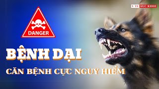 Tổng quan về bệnh Dại. Nguyên nhân, triệu chứng và cách phòng bệnh
