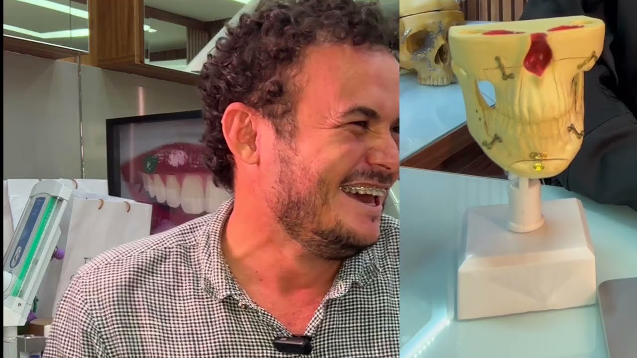 Assimetria corrigida por Ortognatica - Entrevista OrtogCast - Paciente Júlio