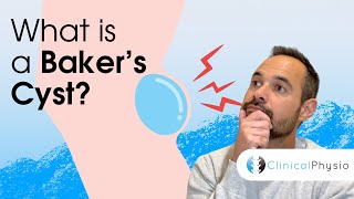 What is a Baker's Cyst?! | Expert physio explains anatomy, diagnosis and treatment of a Bakers Cyst
