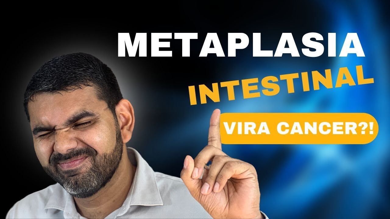 O que é Metaplasia Intestinal ? Metaplasia tem Cura? Metaplasia é câncer? Como prevenir? #gastrite