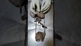 || Kidney || || Renal System || #shorts #anatomy #dissection #shortsyoutubeindia #shortsyoutube