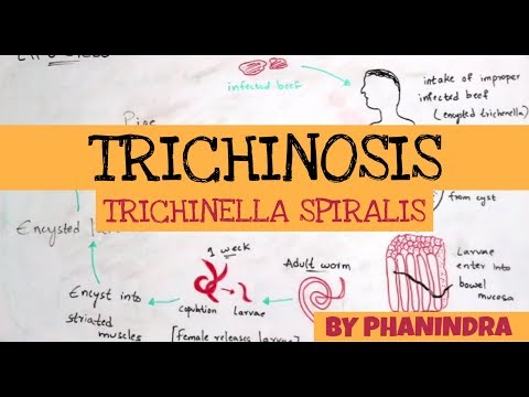 Trichinosis jellemző