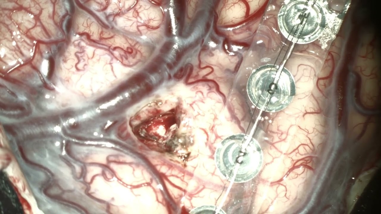 Mickaela Echavarria Demichelis-38