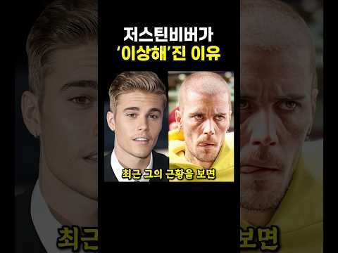 요즘 저스틴비버가 ‘이상해’진 이유 중 하나.. ㄷㄷ