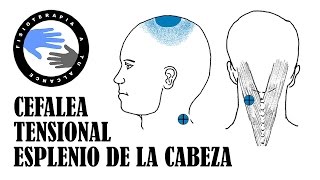 Dolor de cabeza, masaje del musculo esplenio de la cabeza para la cefalea tensional