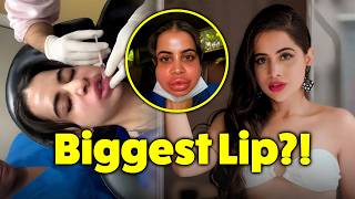 Urfi Javed Removes Her Lip Fillers