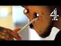 Man With Holes In His Face | Bodyshockers