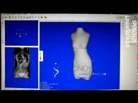 - Spondylos Laser Spine Lab - Spondylos Laser Spine Lab