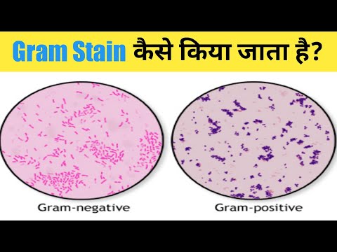 Gram Stain कैसे किया जाता है ? GRAM STAINING | How to prepare the perfect Gram stain
