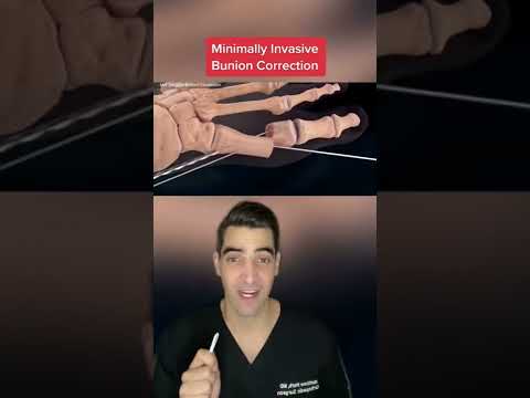 Bunion correction