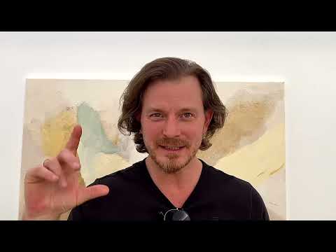 Die Monate nach meiner Haartransplantation