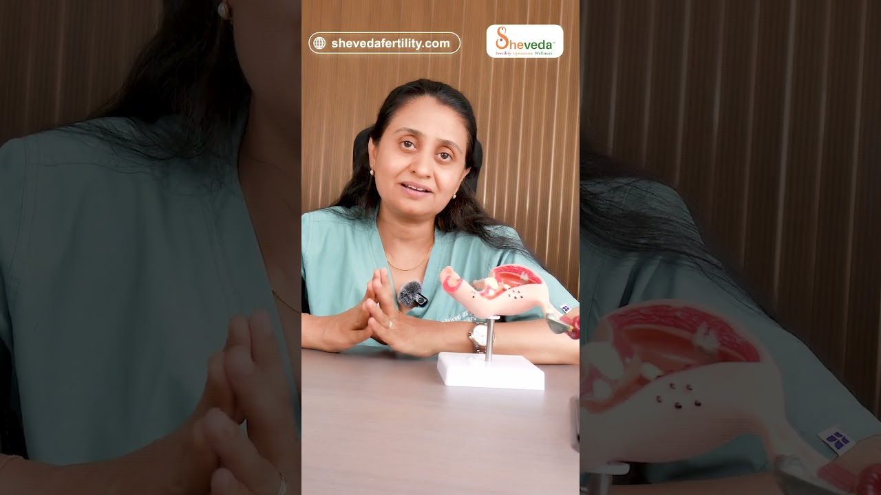 PCOS Improve Nahi Ho Raha? Shayad Sequence Galat Hai