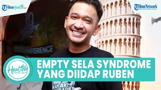 Mengenal Empty Sella Syndrome, Penyakit Langka yang Diidap Ruben Onsu, Ini Gejala dan Cara Atasi