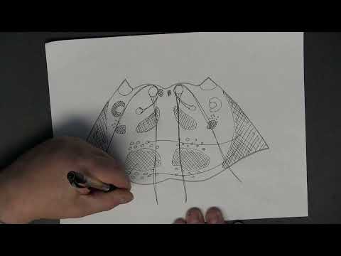 Vascular Lesions of the Brainstem