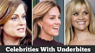 Celebrities With Underbites YOU MUST SEE!!!