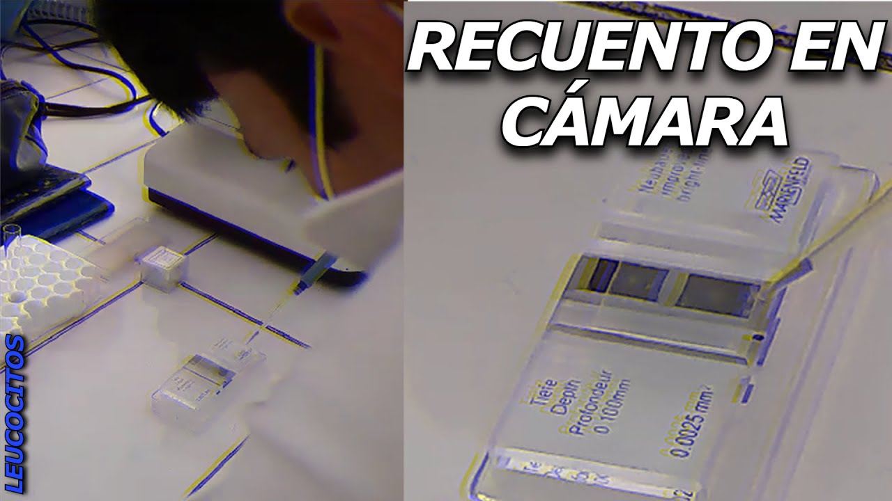 Procedimiento Paso a Paso: Recuento de Leucocitos en Cámara Neubauer