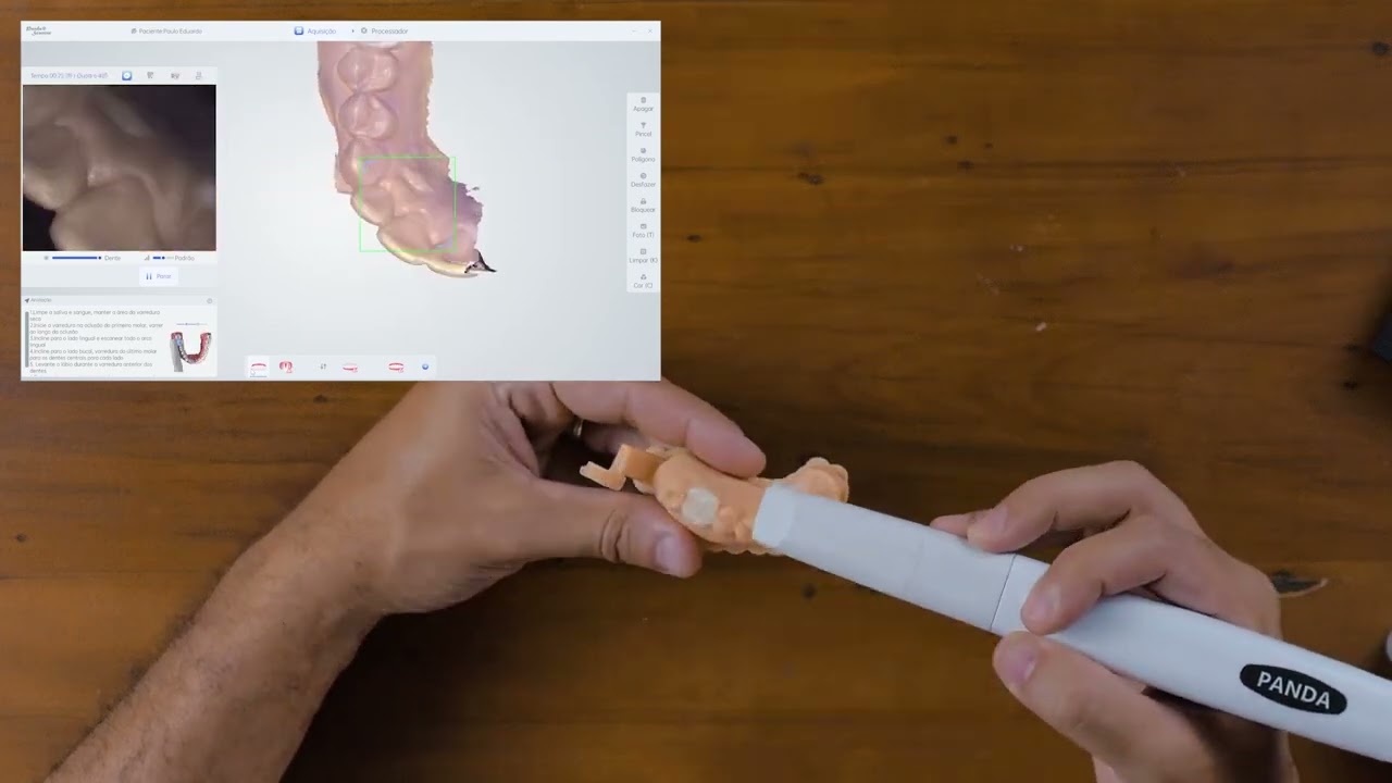 Vídeo 17 - Escaneamento Pré-Operatório