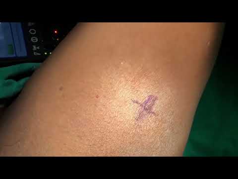 Patient Testimonials