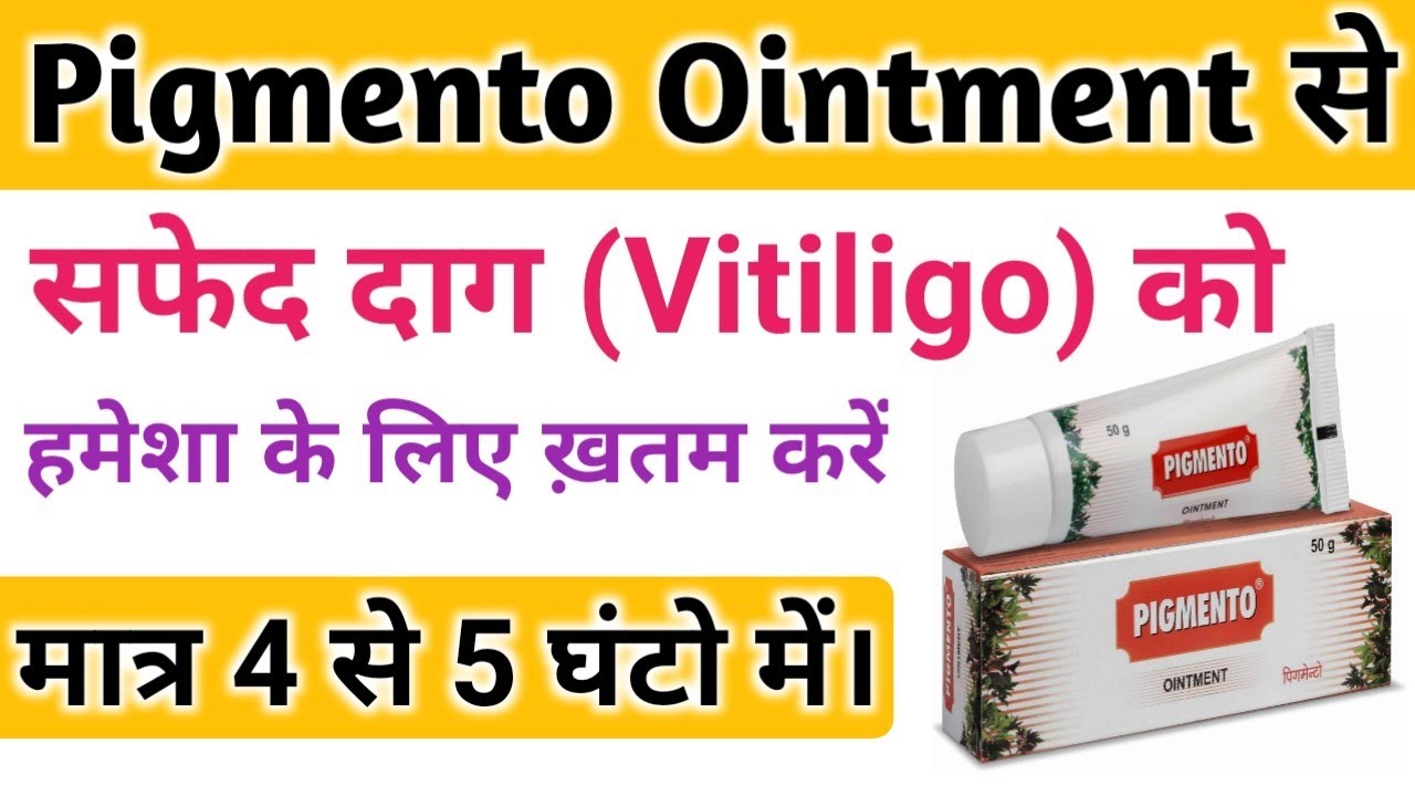 Pigmento Ointment Uses in hindi || सफेद दाग का इलाज || अब मात्र 4 से 5 घंटो में | Vitiligo Treatment