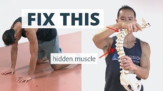 Wake Up This &quot;Hidden&quot; Muscle to Fix HUNCHBACK Posture (aka Kyphosis)