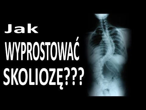 Uszkodzenie mięśnia łydki na nodze Botox jest mięśniem depresor