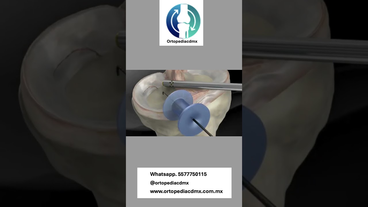 Carlos Ignacio Muñoz Valadez-53