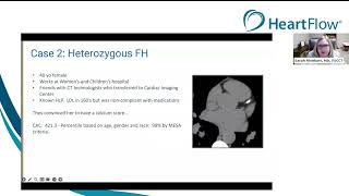 Sponsored webinar|Utilizing lesion-specific physiology & quantified plaque to inform decision-making