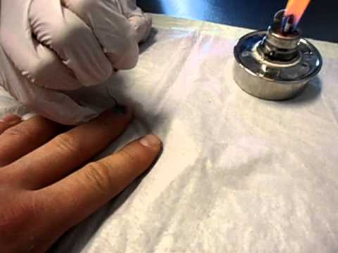 Gribok auf den Beinen die Behandlung der Salbe Nogtewoj gribok der Finger der Hände