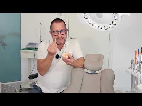 Bohrschablonen für Zahnimplantate – warum ist das wichtig? (von Sascha Leppich)