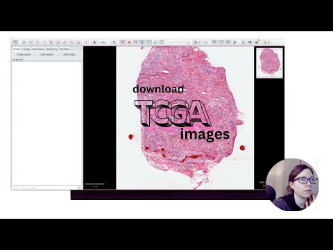 Download cancer images from TCGA
