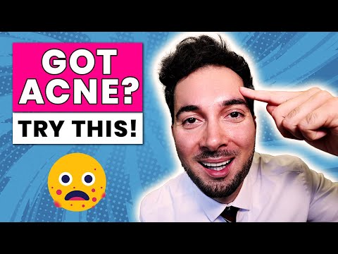 How To Get Rid of Acne Best Spot Treatment How To Use Benzoyl Peroxide Prevent Acne 2018