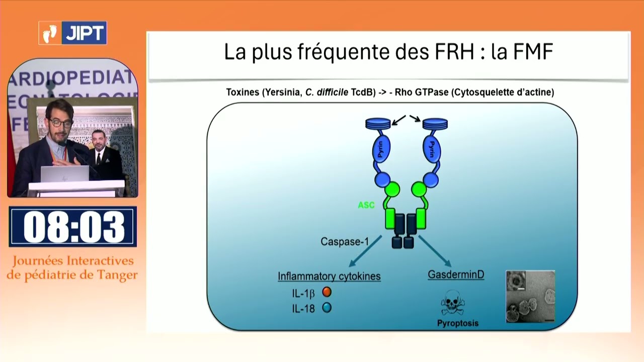 Journées interactives de Pédiatrie de Tanger 2025 -Quand la fièvre n'est pas infectieuse : Pr. BELOT