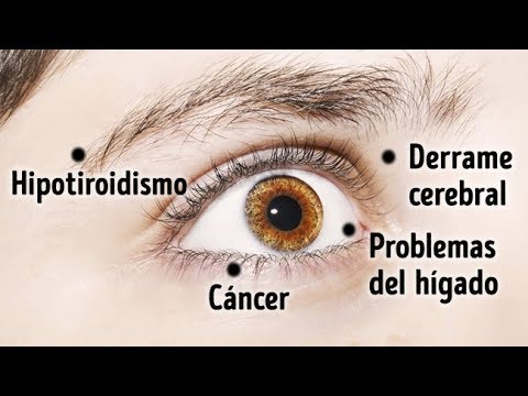 8 Cosas Que Tus Ojos Dicen Sobre Tu Salud