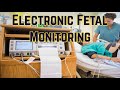 Electronic Fetal Monitoring - CRASH! Medical Review Series