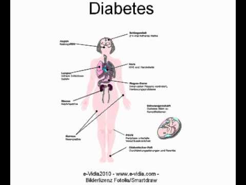 Blut bei Diabetes mellitus Bild Humulin NPH-Insulin in Apotheken verkauft