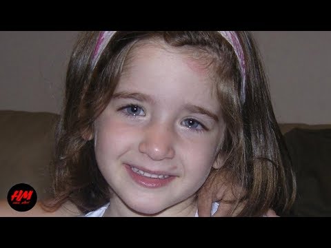 Il trattamento di pigmentary nota bioptrony Se sono piacevoli ai ragazzi della ragazza con lentiggini