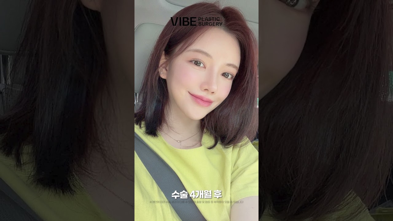 코성형(실리콘, 비중격, 귀연골, 기증늑, 복코, 짧은코)