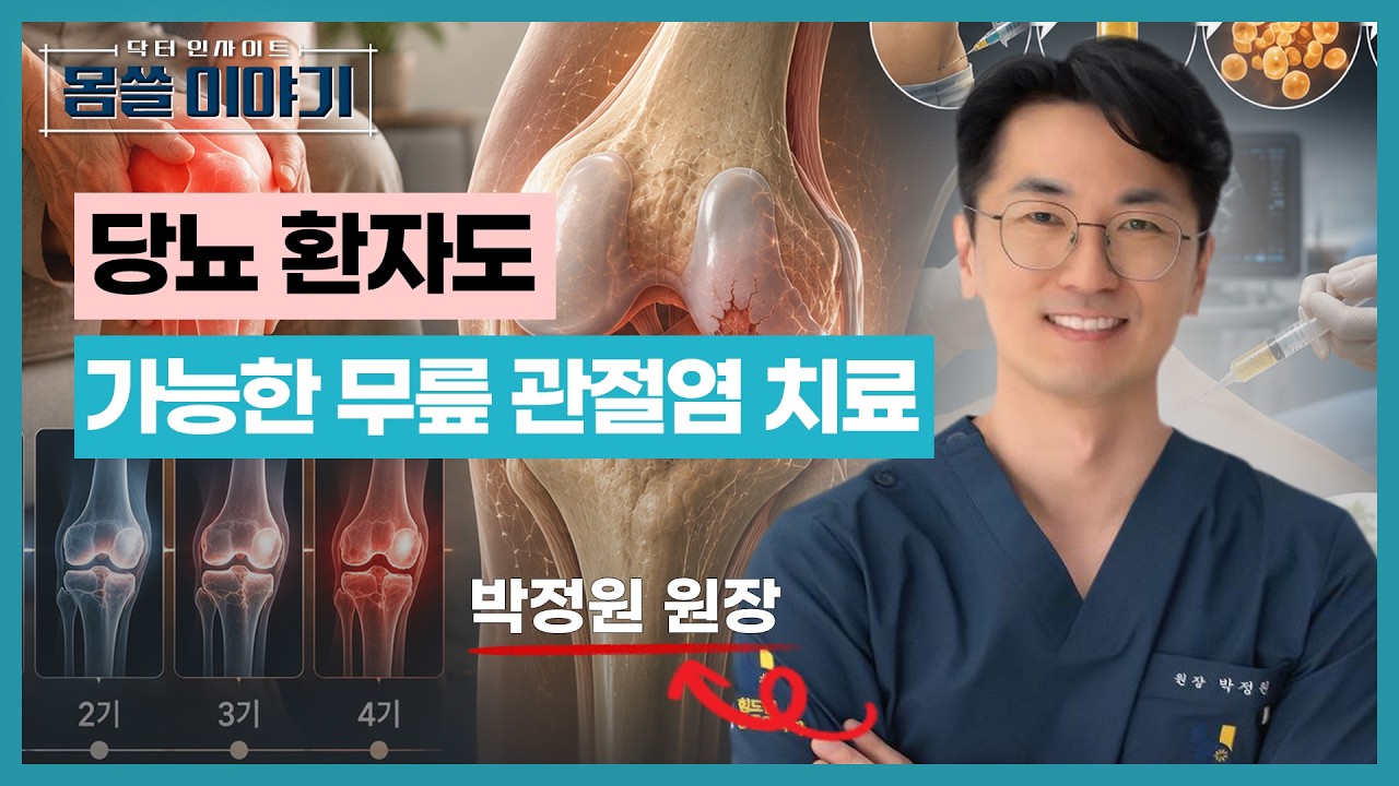 퇴행성 관절염 치료…인공관절 전 마지막 선택은? [몸쓸이야기 28회]