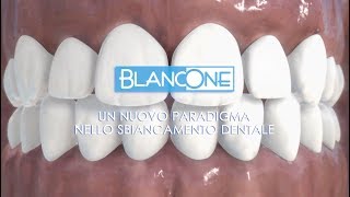 BlancOne: il paradigma del bianco nello sbiancamento dentale (voiceover)