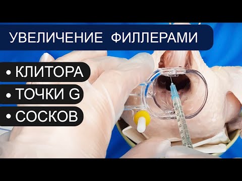 Увеличение клитора, точки G, сосков филлерами / контурная пластика/ гиалуроновая кислота