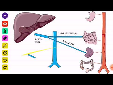 "Portal hypertension(PHT) " tropical -ASM MINDS-