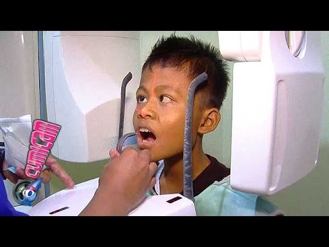 Sonny, Tegang Karena Gigi - Cumicam 10 Oktober 2015