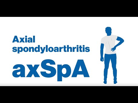 More than just back pain, what is Axial Spondyloarthritis (axSpA)?