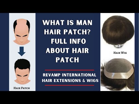 Male Mens Mono Hair Patch Service