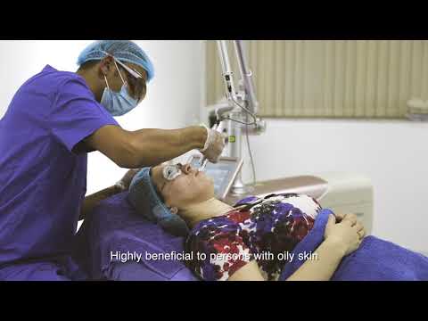 HELIOS III Carbon Laser Peel | Elite Style Polyclinic | Dubai