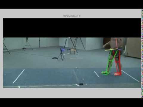 Markerless Body Parts Tracking - Tremor analysis for Parkinson Disease Patients.