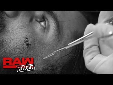 Seth Rollins Requires Stitches After RAW