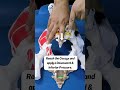COCCYDYNIA TAIL BONE PAIN TREATMENT BY SACROCOCCYGEAL LIGAMENT RELEASE TECHNIQUE